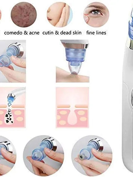 Blackhead Removal Machine Derma Section 4 In 1 Acne Pore Cleaner Suction Tool Blackhead Removal